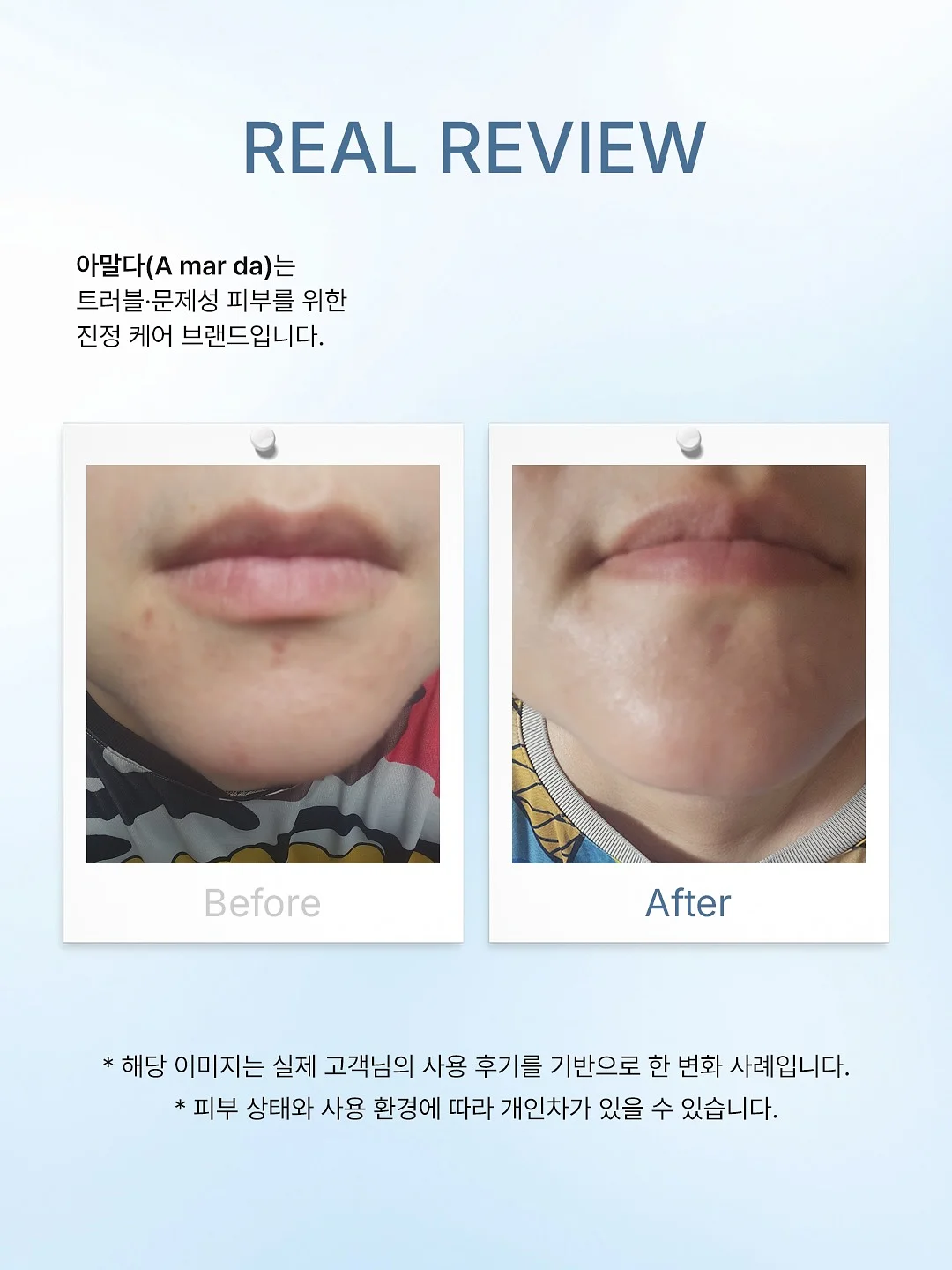 푸푸엔자임 3