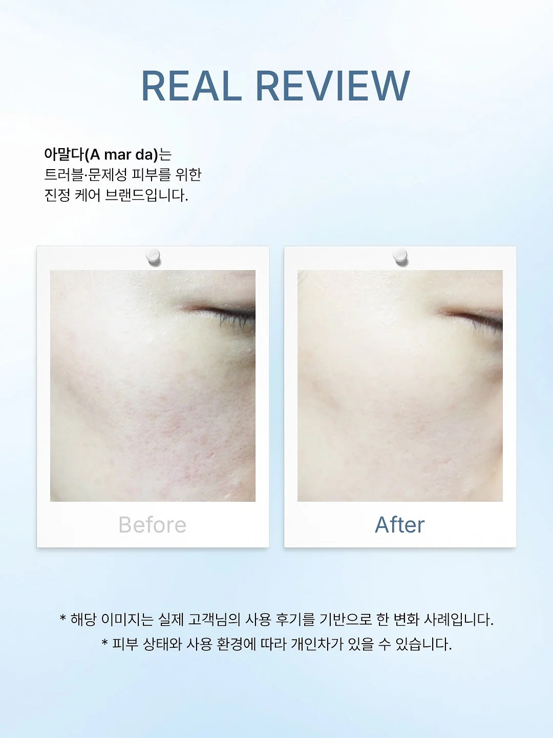 푸푸엔자임 4