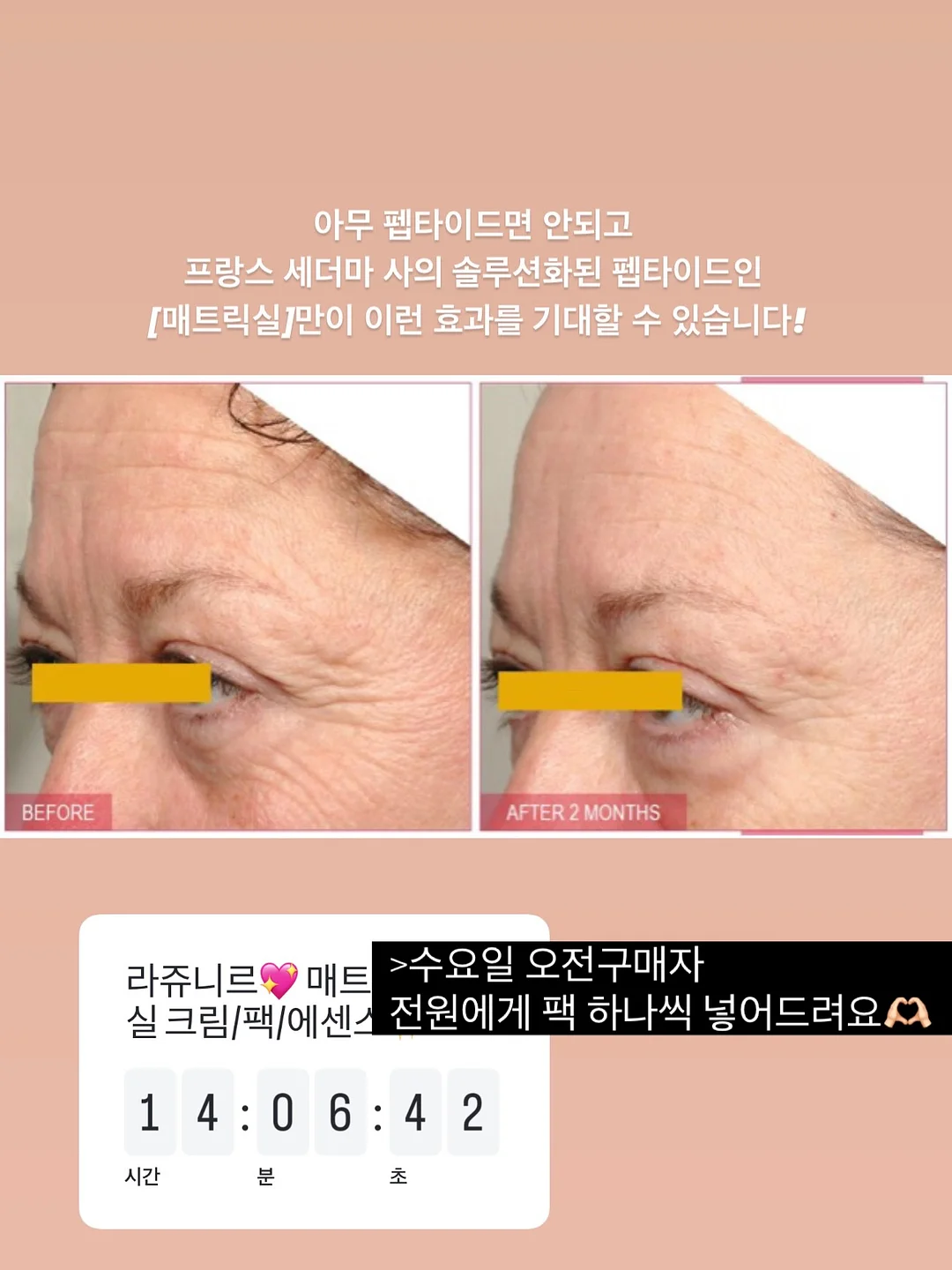 의류 11