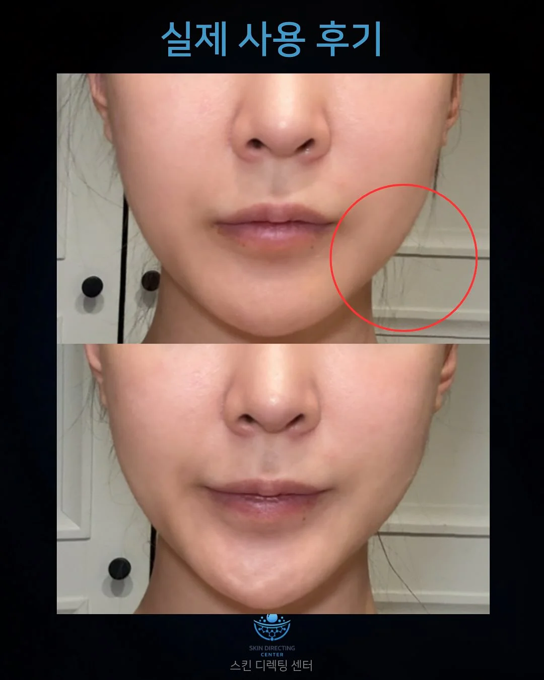 노모어댄 코튼블루 캐리어 15