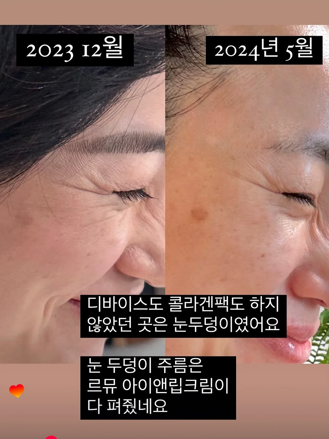 ovhee 숄더백 5