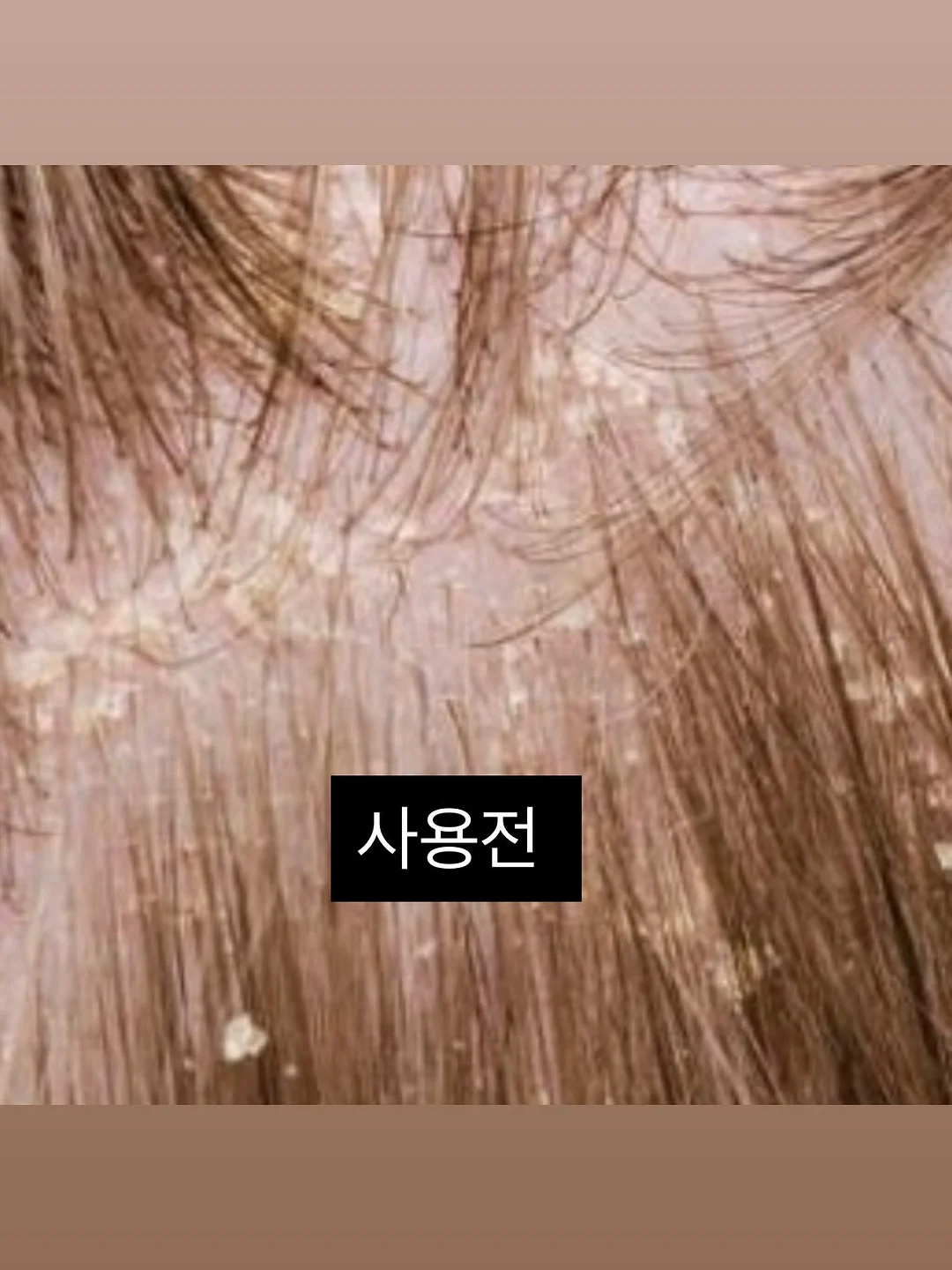 밀하 제니스커트 & 아일렛 벌룬티 & 리본 헤어밴드 세트 5