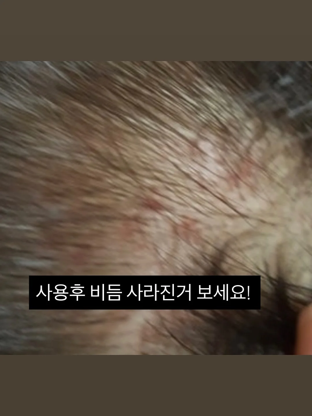 밀하 제니스커트 & 아일렛 벌룬티 & 리본 헤어밴드 세트 6