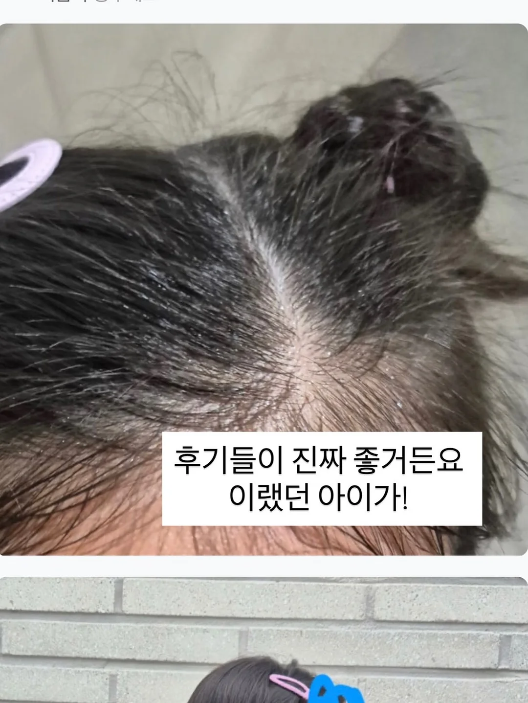밀하 제니스커트 & 아일렛 벌룬티 & 리본 헤어밴드 세트 7