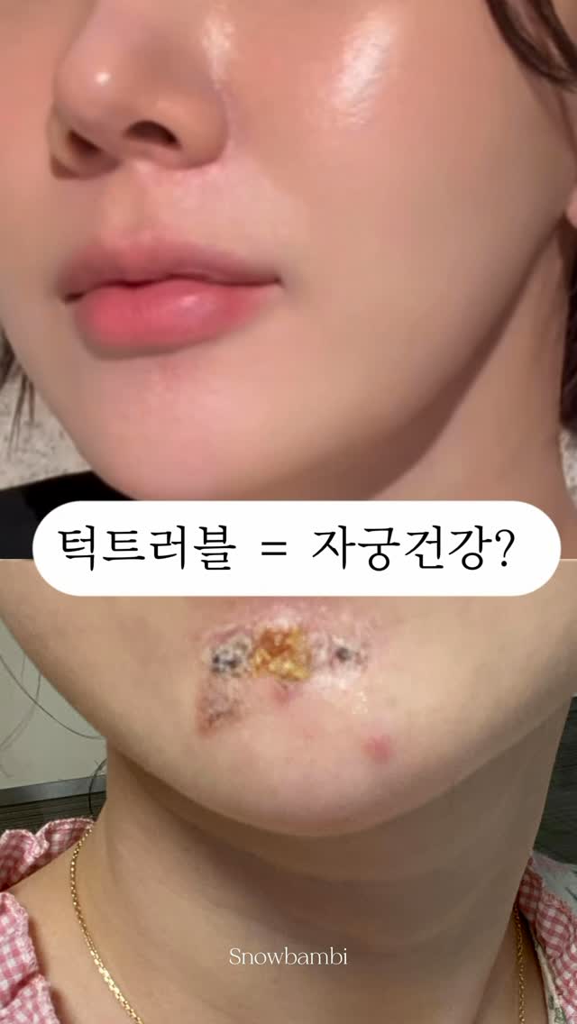 뷔스티에
