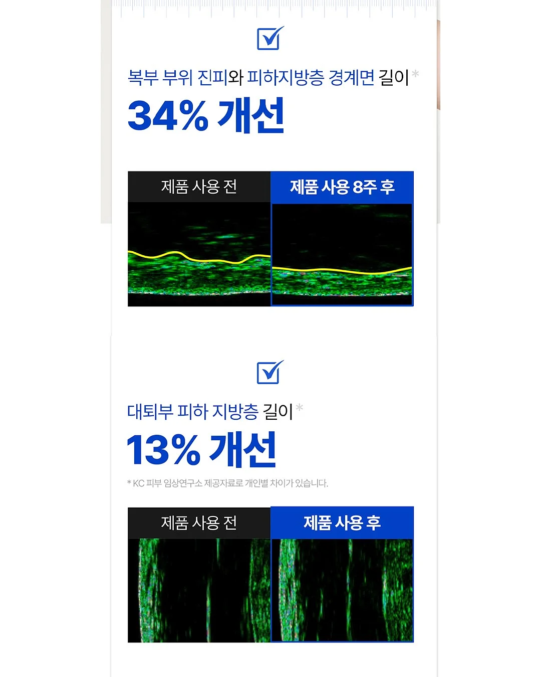 대왕파 케이크 14