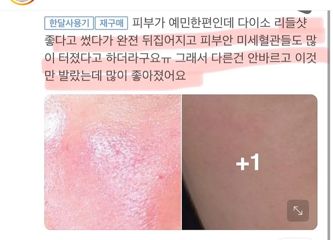 콩알금 2