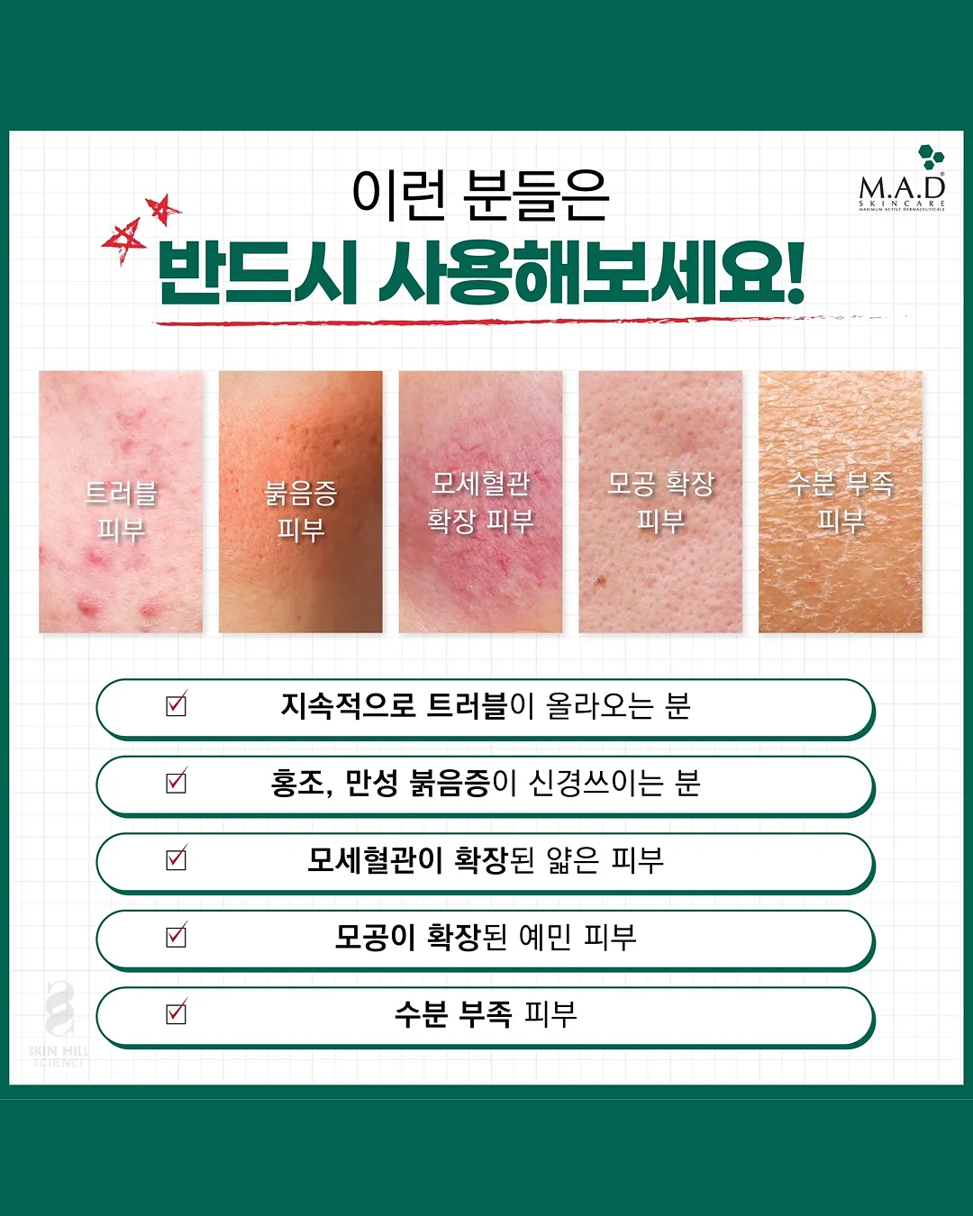 살루드 수에노 필로우 미스트 3
