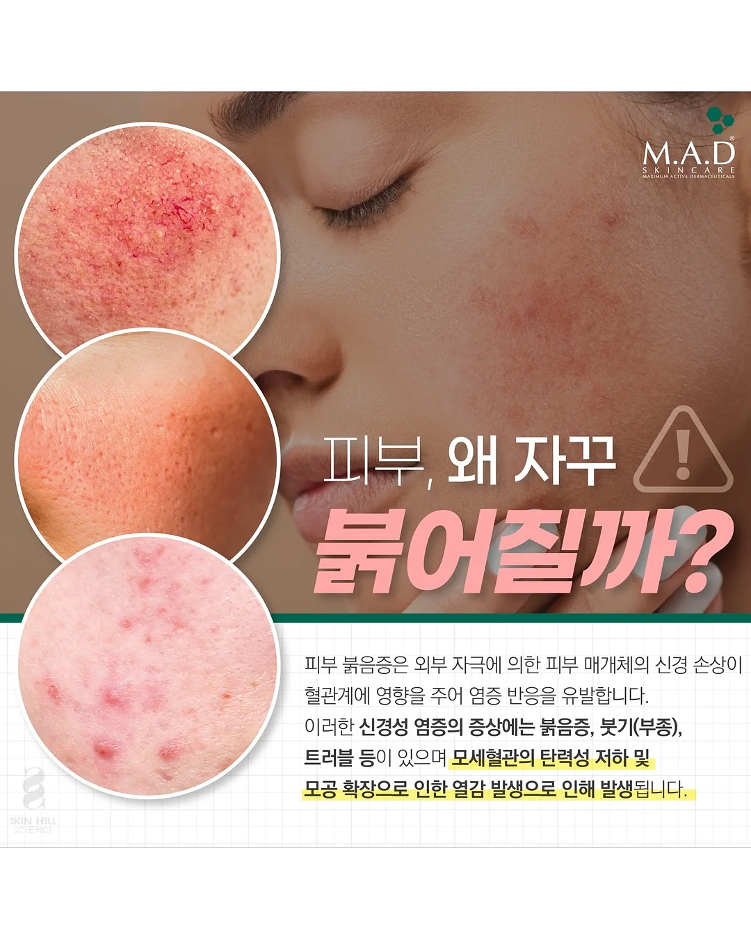 살루드 수에노 필로우 미스트 6