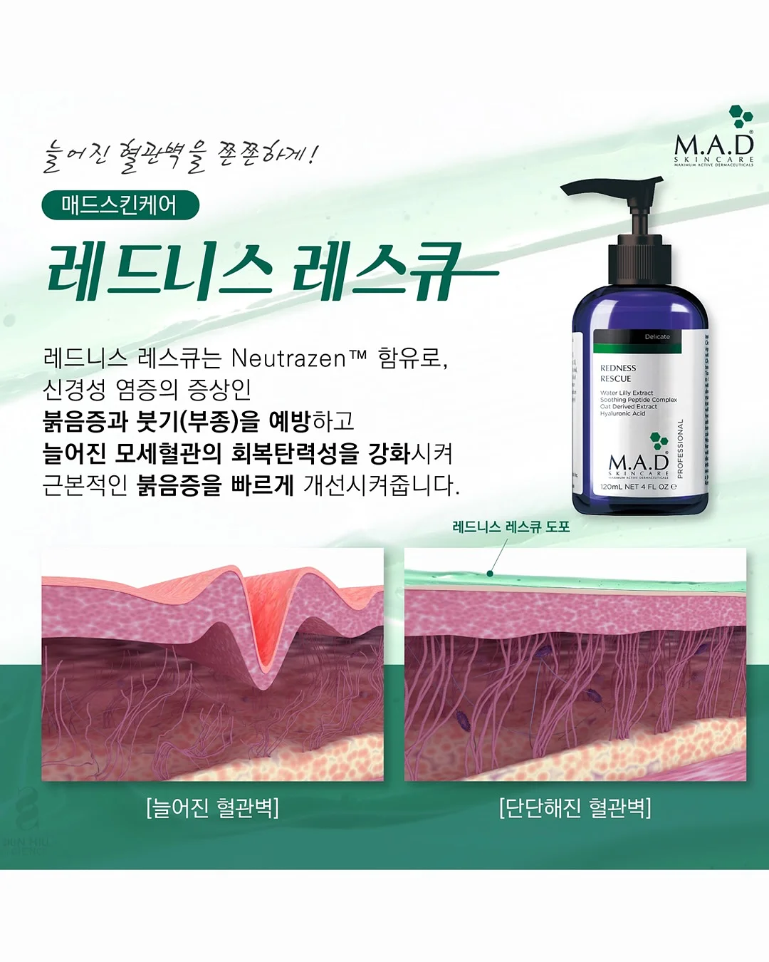 살루드 수에노 필로우 미스트 8
