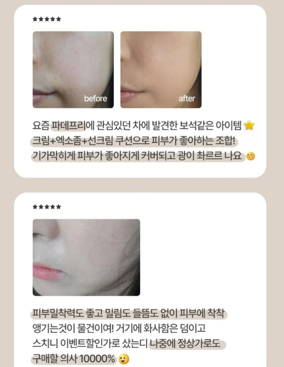 엔티타 마사지 젤 5