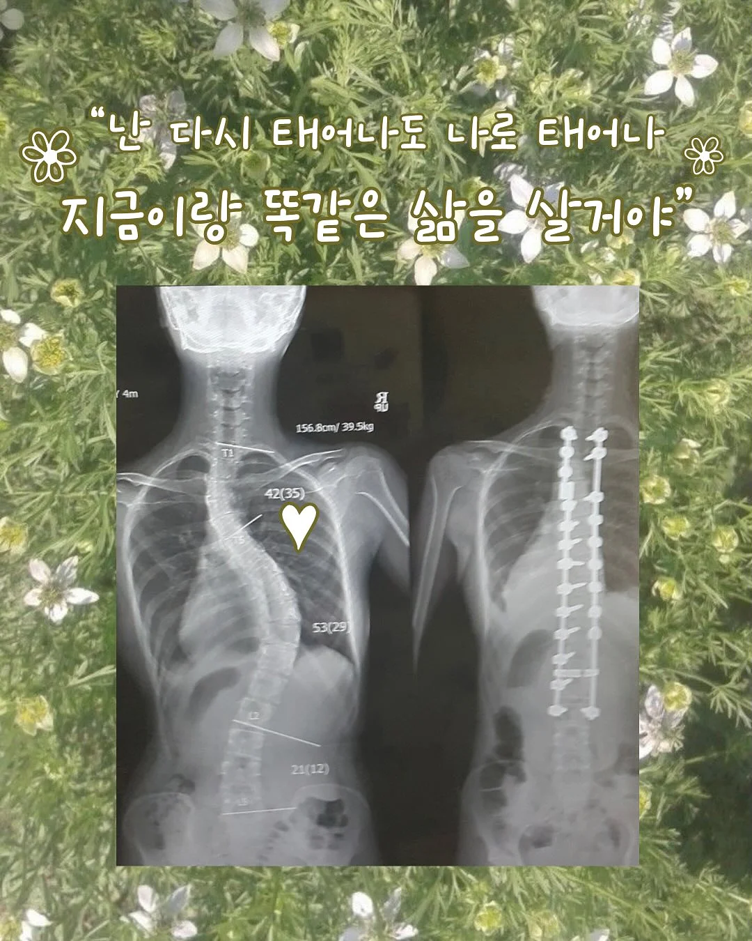 미태그 1