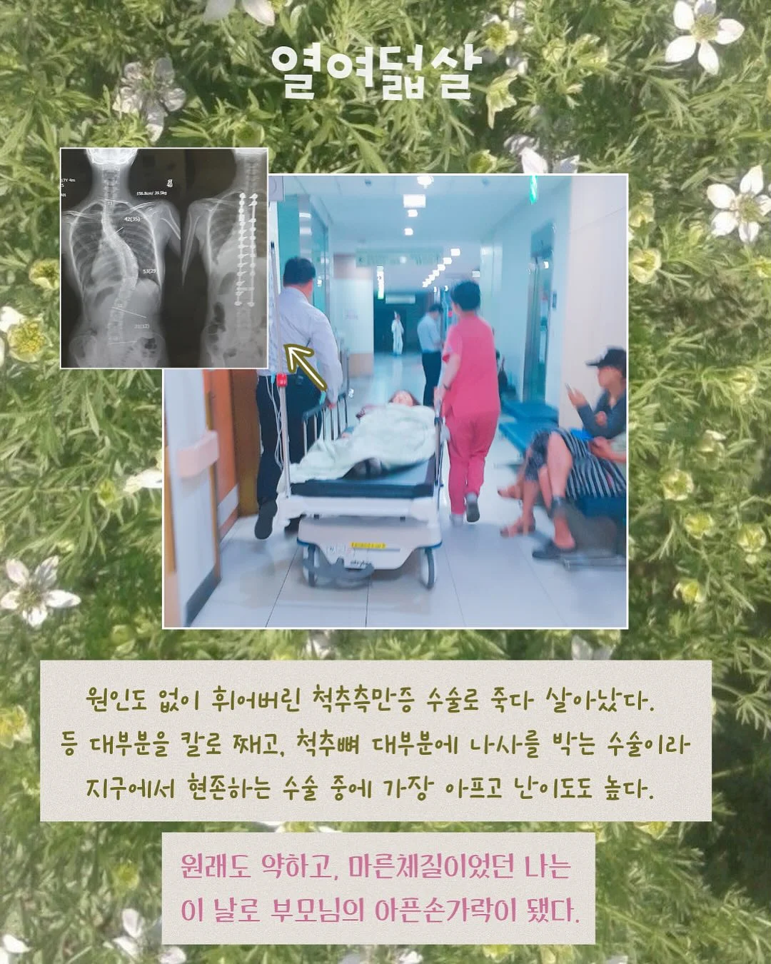 미태그 3