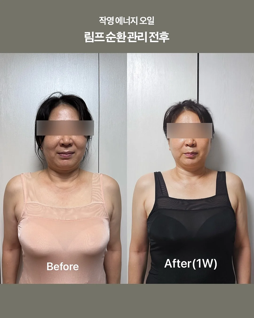 모기기피제 2