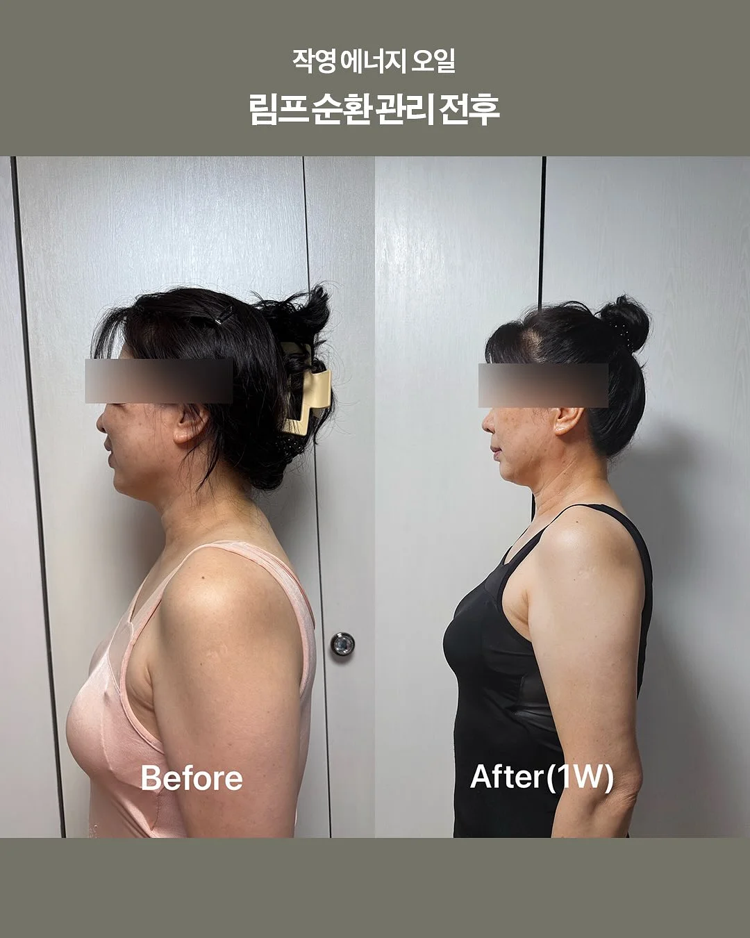 모기기피제 3