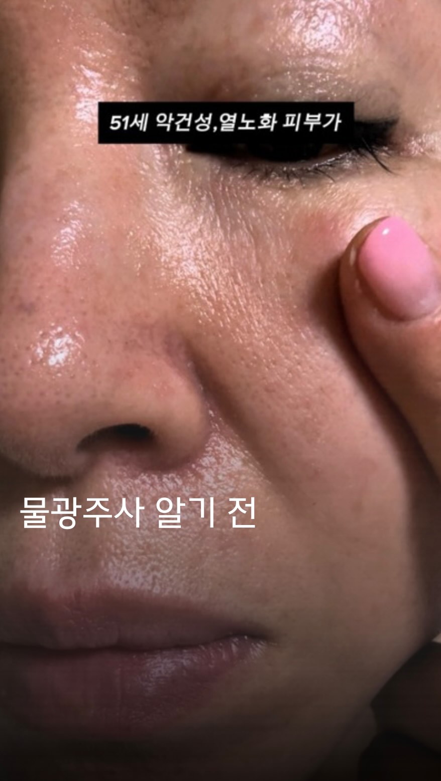 캔서카운슬 선크림
