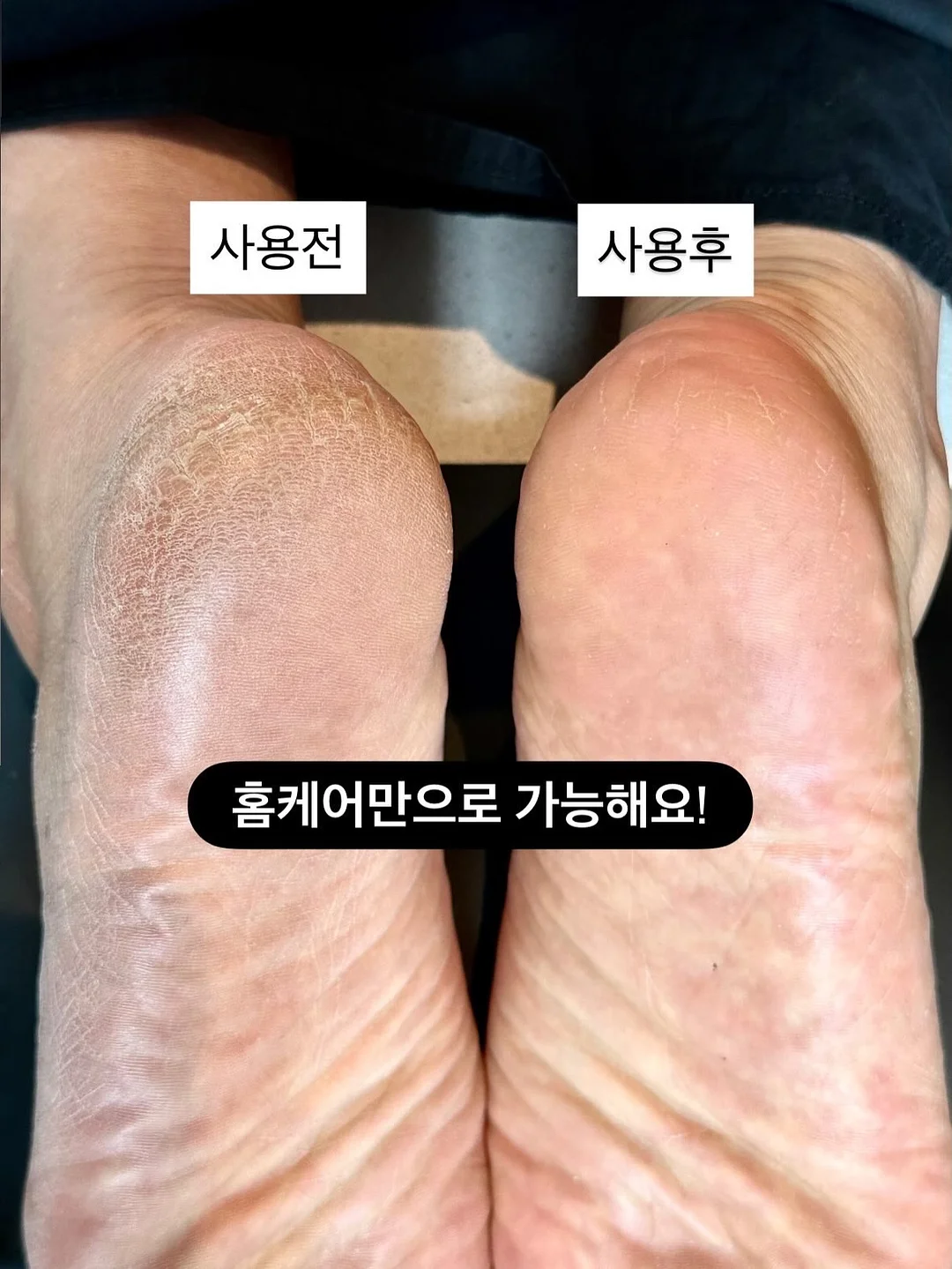 스승의날 선물 카드꽂이, 토퍼 4