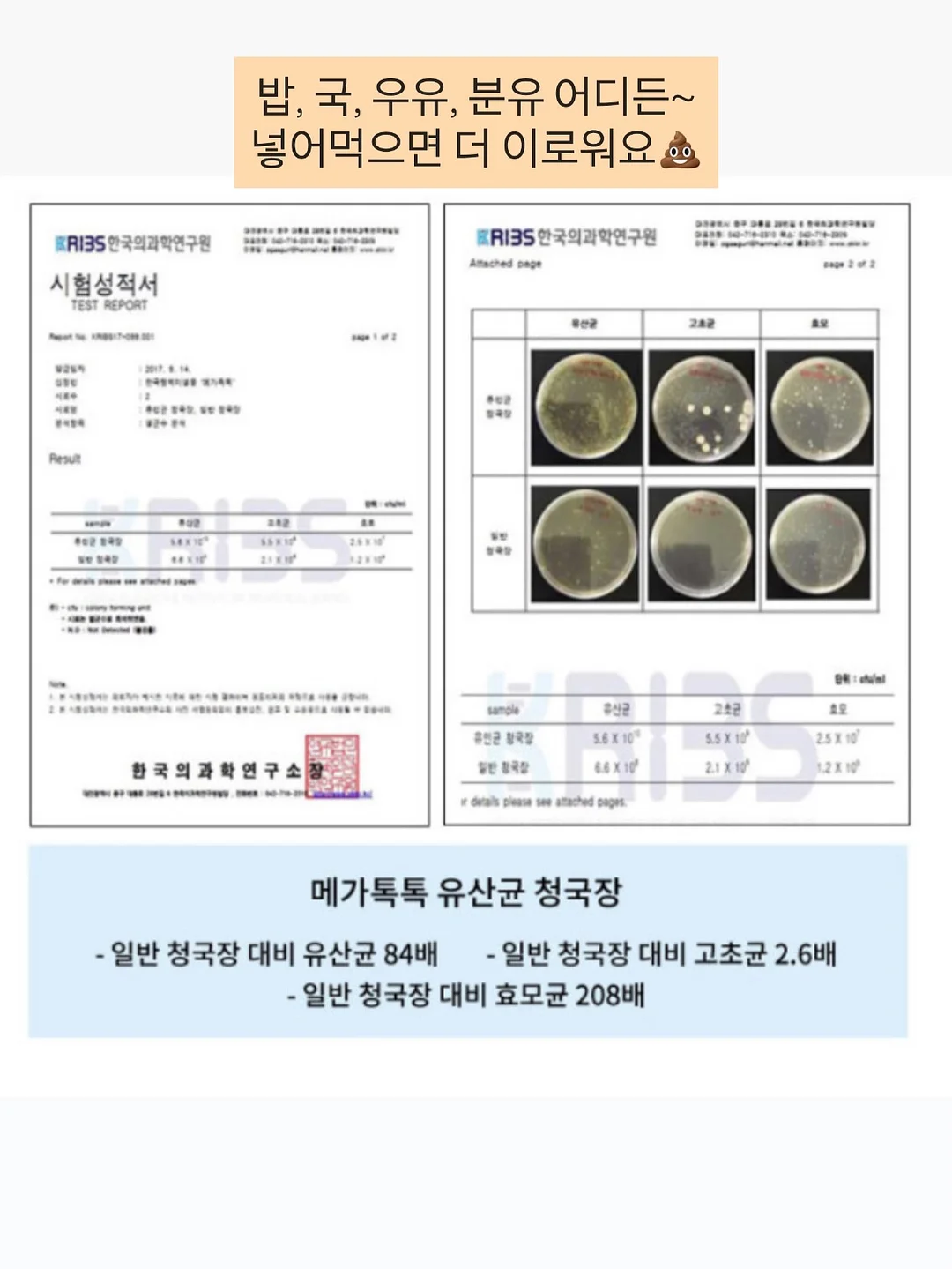 스투시 자수 후드 베스트 7