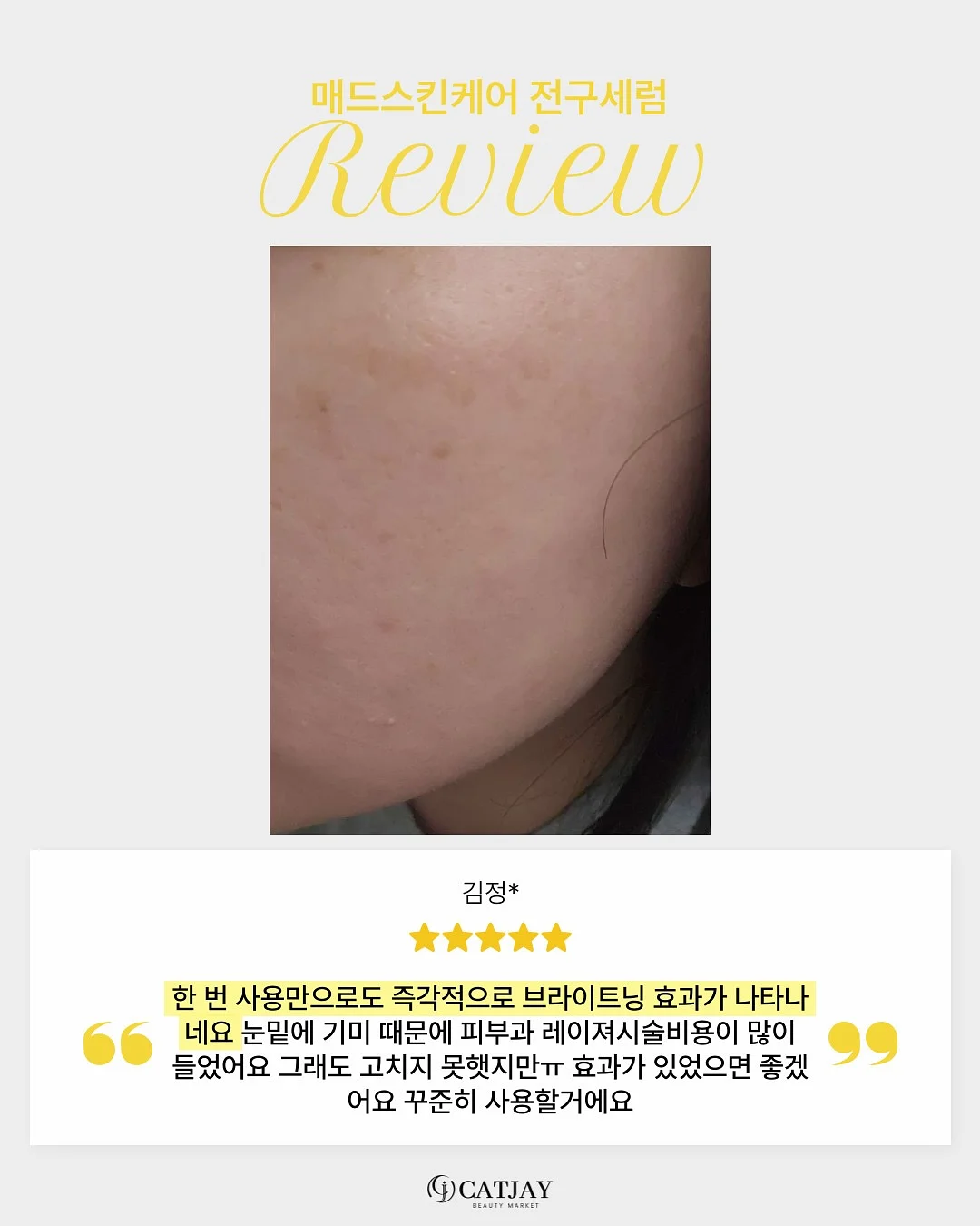 사자발고사리 7