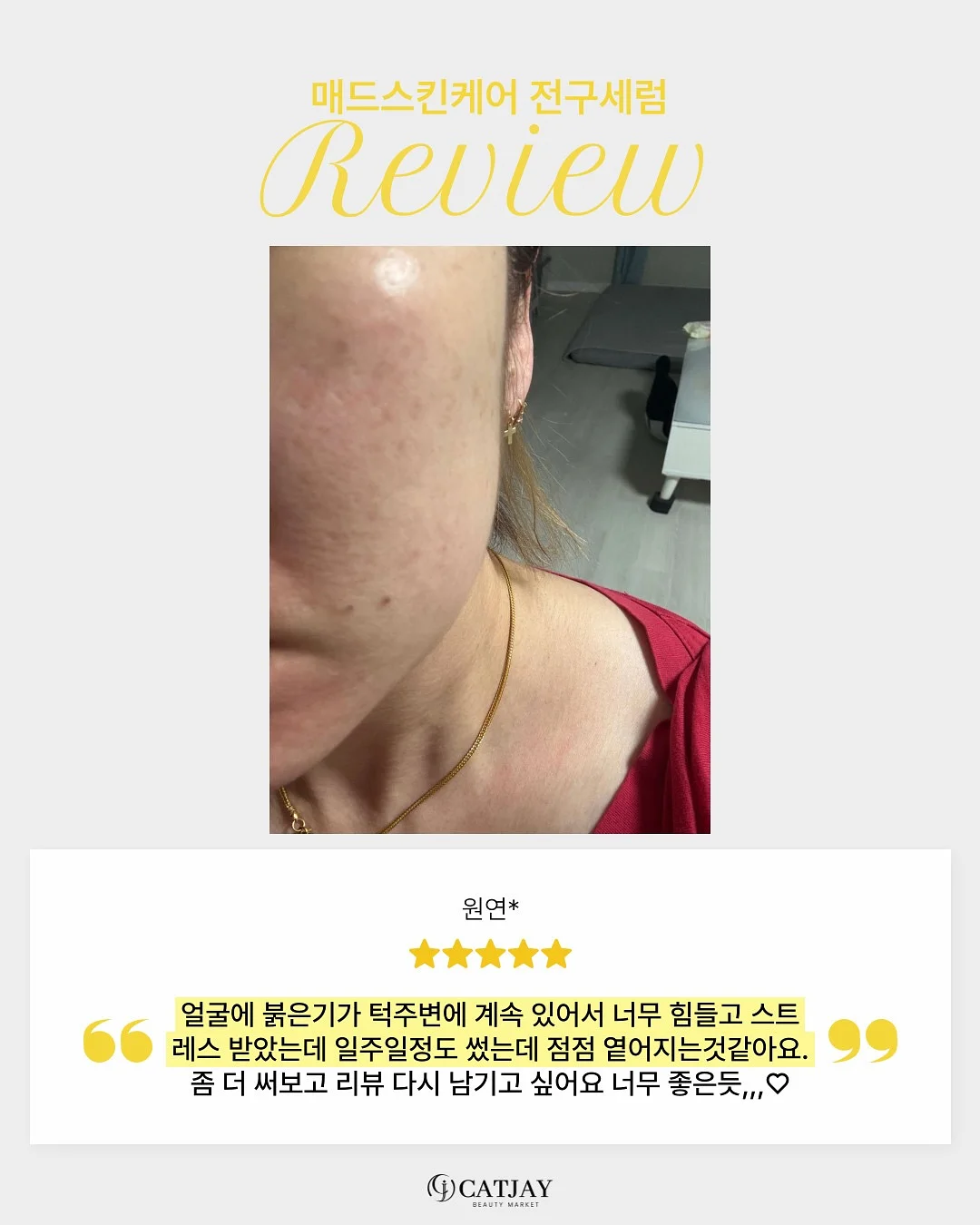 사자발고사리 10