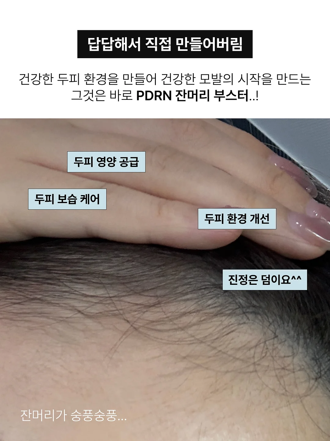 젤 네일아트 3