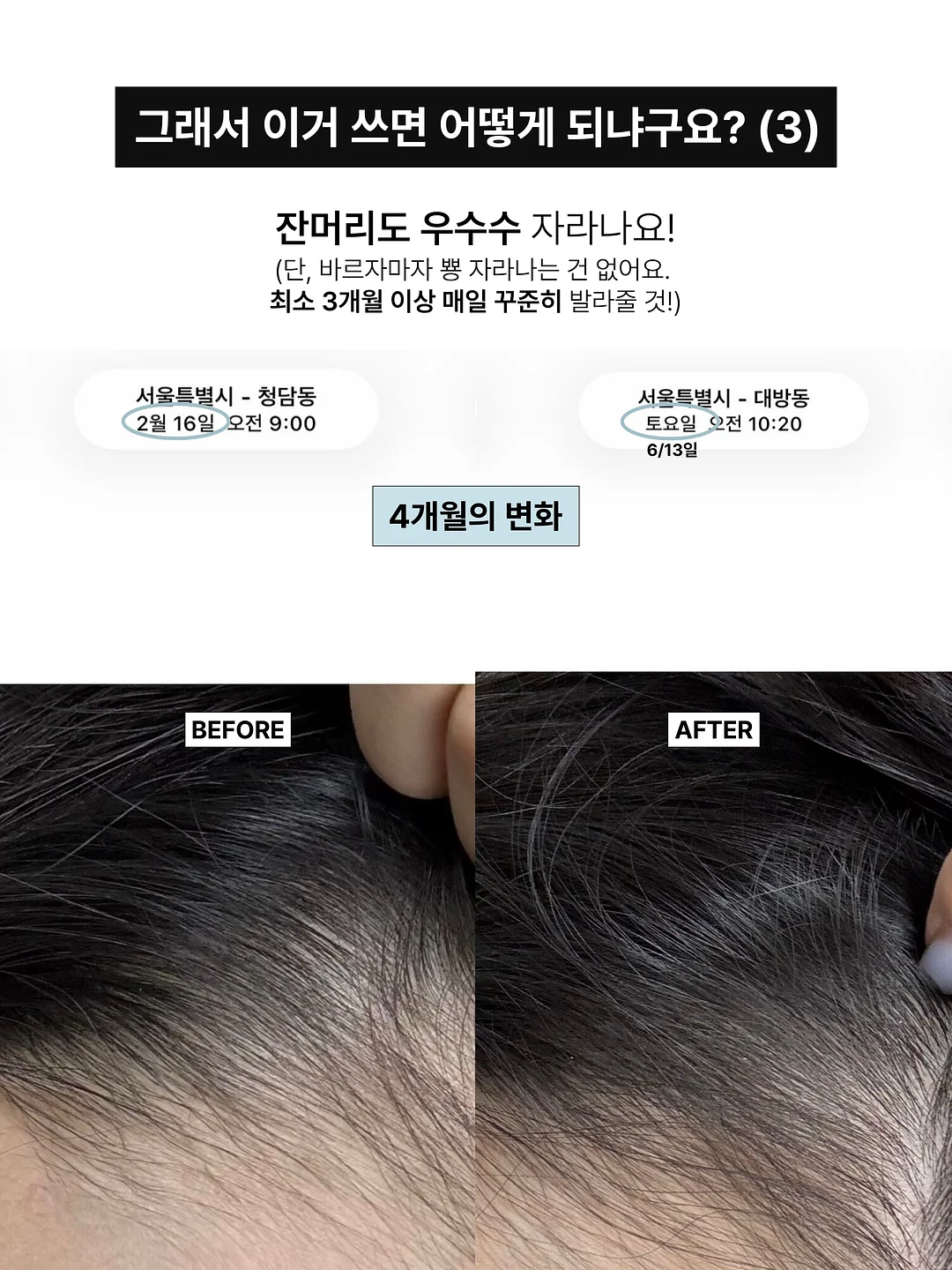 젤 네일아트 7