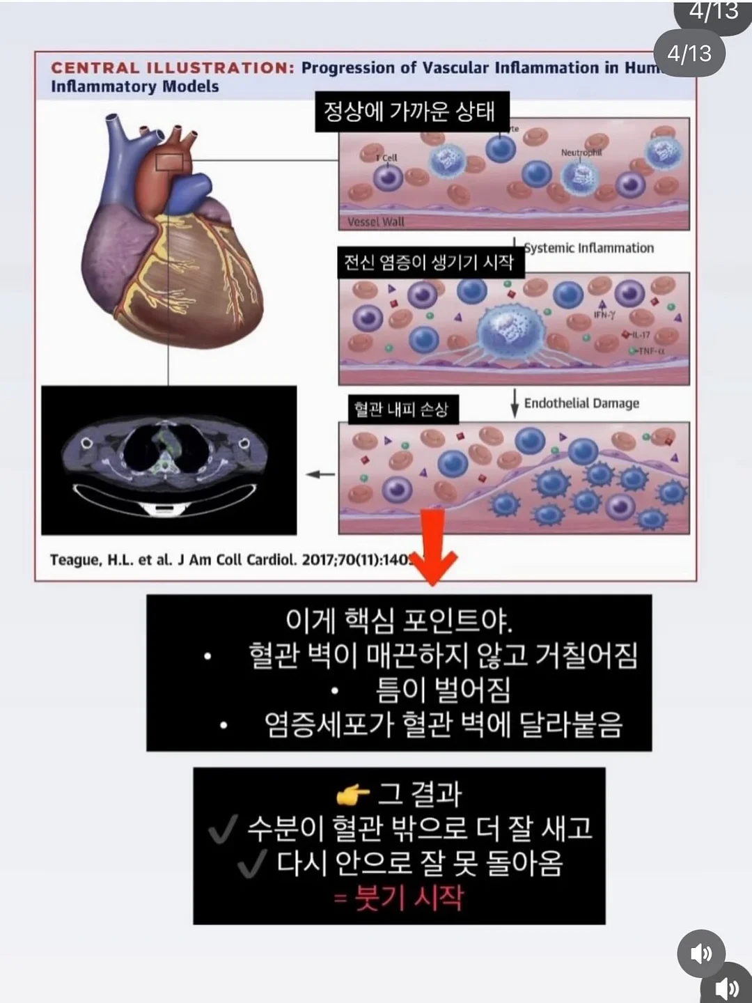 프라다 갤러리아 미니백 4