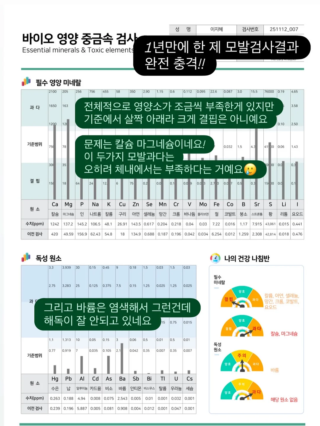 지지미 체크 호박원피스 2