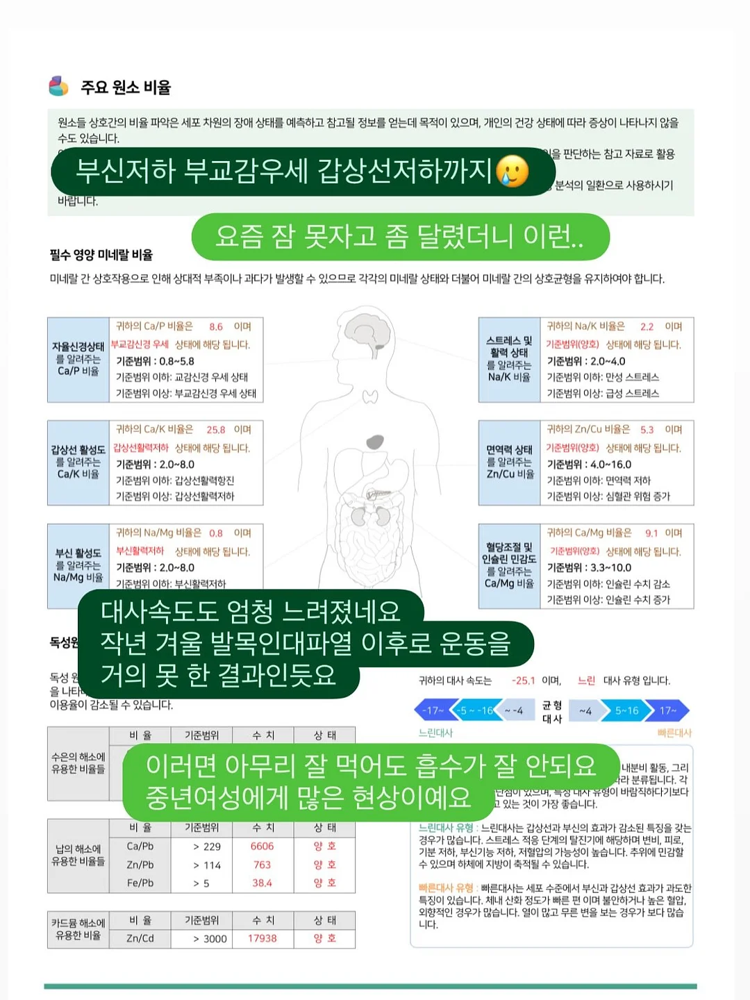 지지미 체크 호박원피스 3