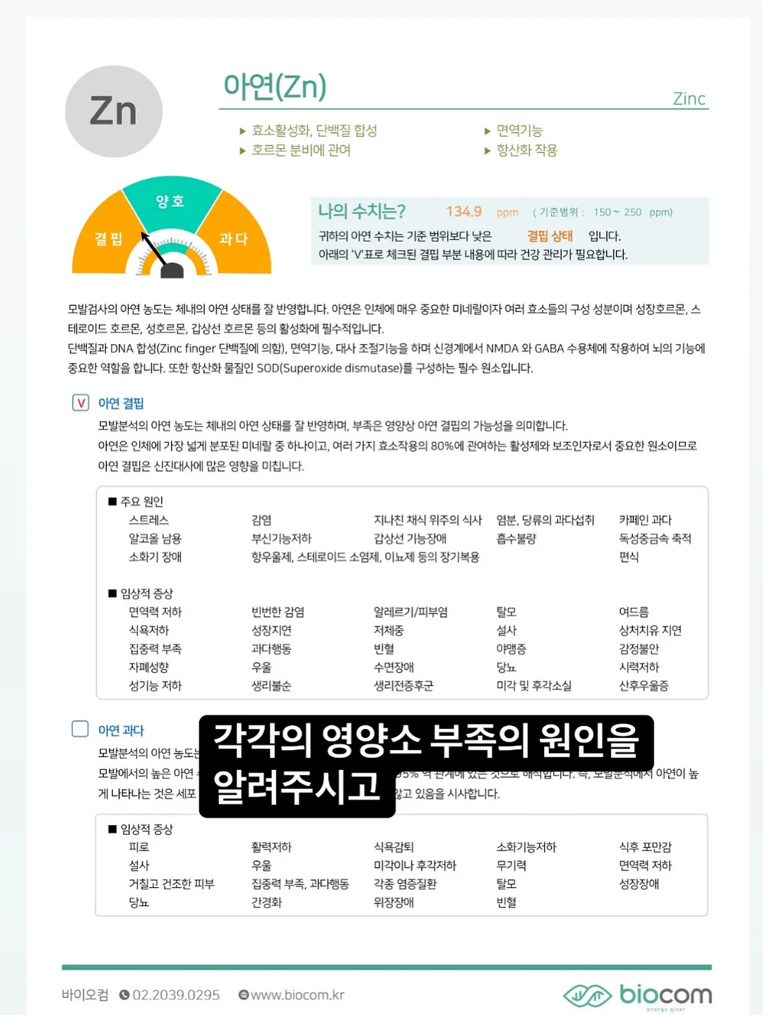 지지미 체크 호박원피스 4