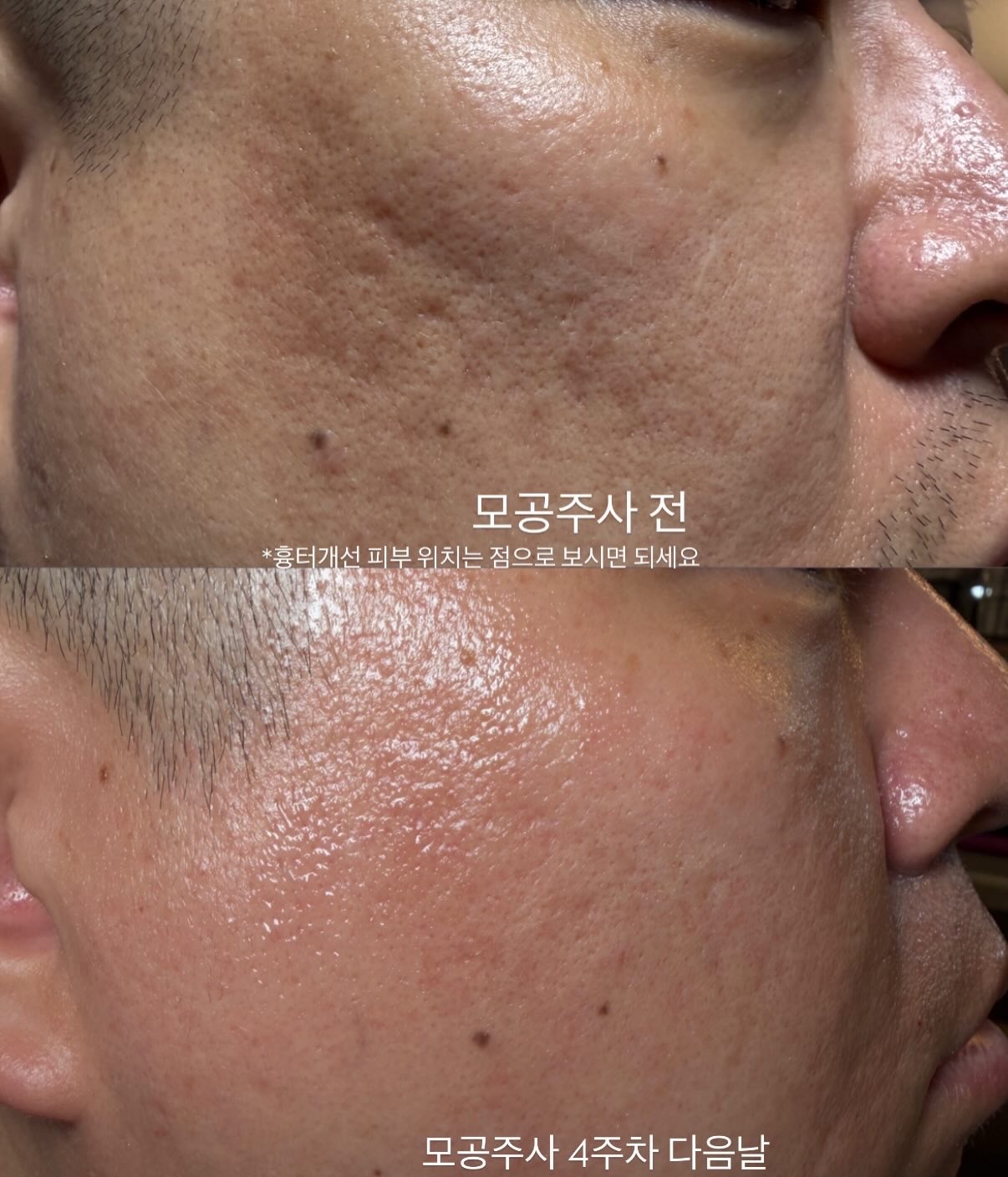 바이오워싱 면 티셔츠 2