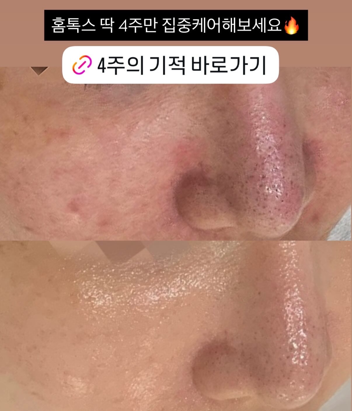 바이오워싱 면 티셔츠 11