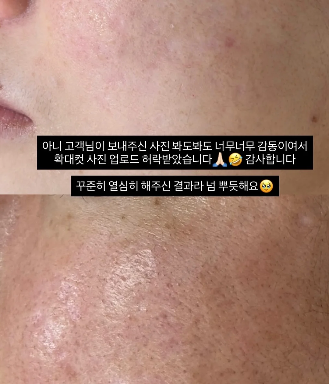 바이오워싱 면 티셔츠 12