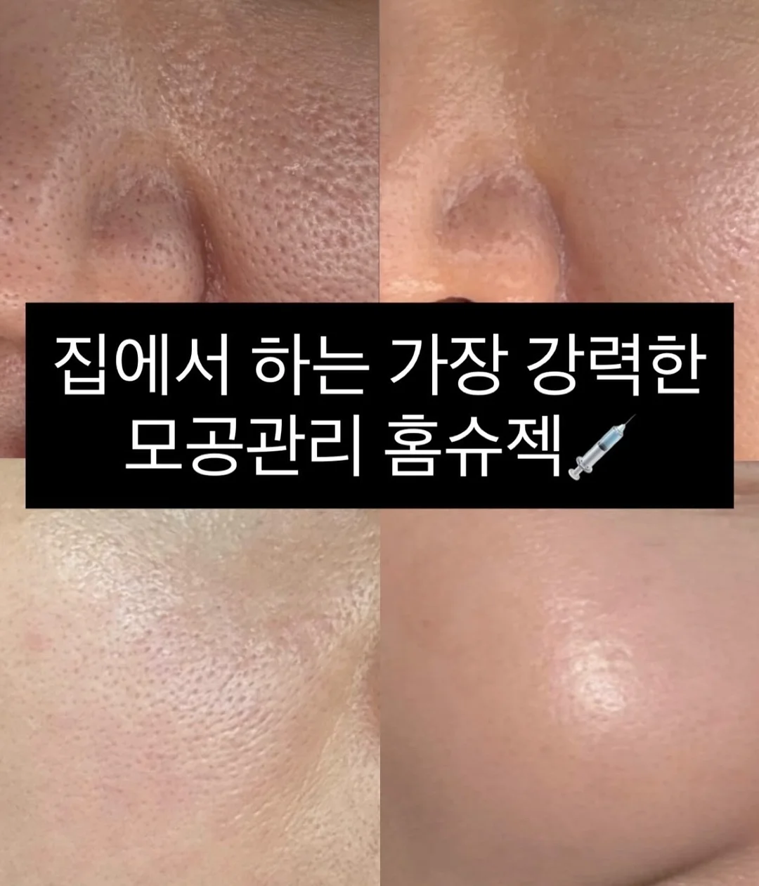 바이오워싱 면 티셔츠 15
