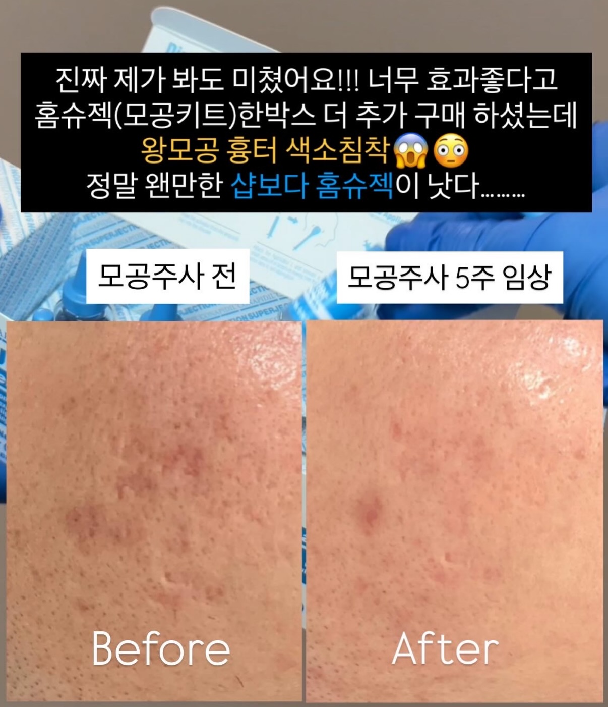 바이오워싱 면 티셔츠 4