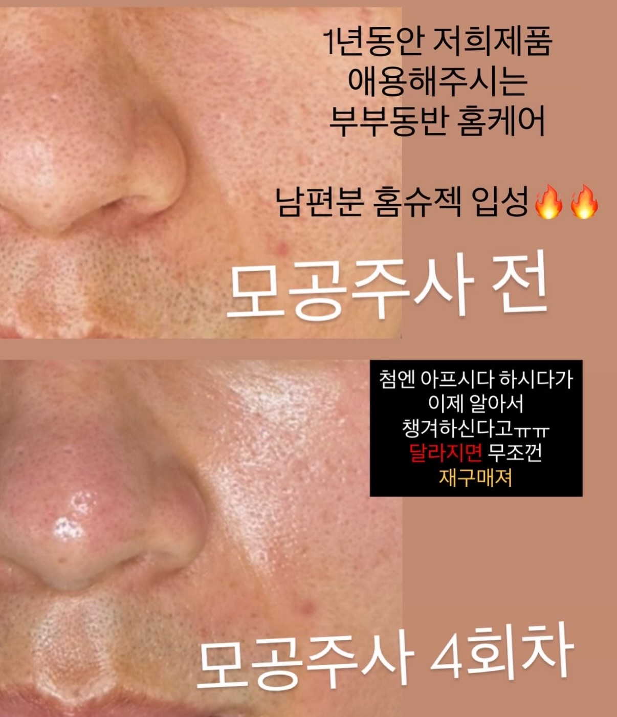 바이오워싱 면 티셔츠 5