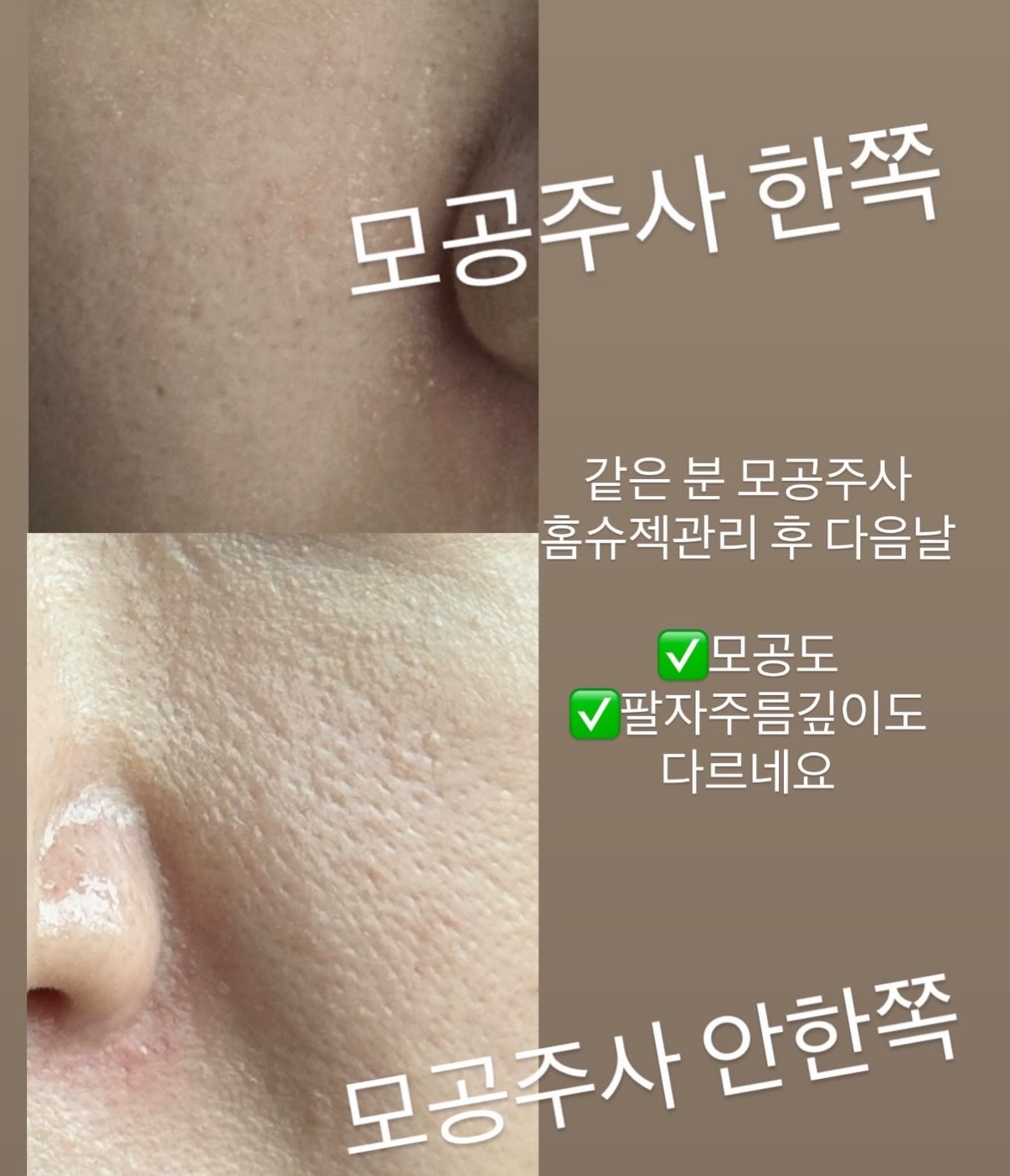 바이오워싱 면 티셔츠 6