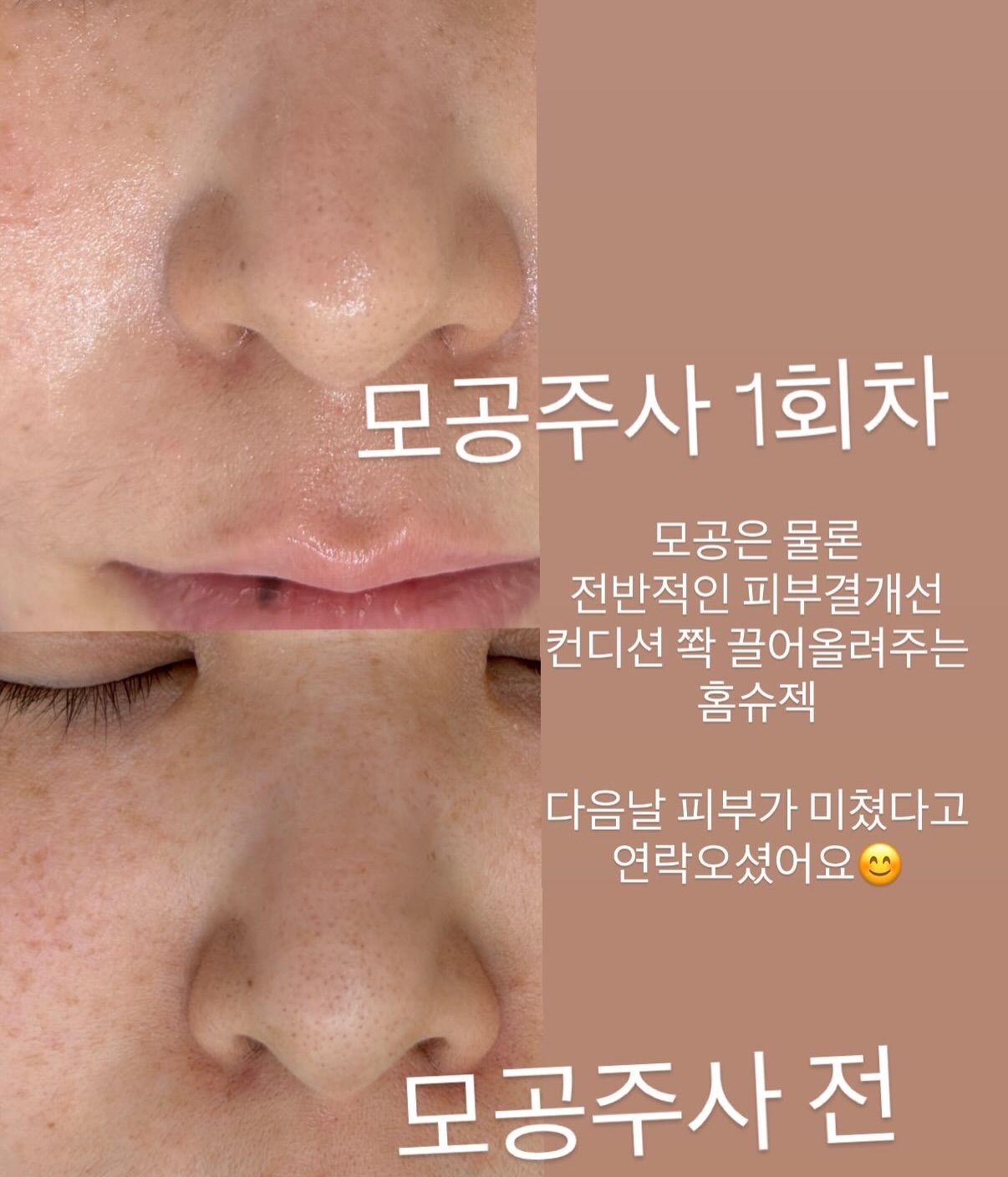 바이오워싱 면 티셔츠 7