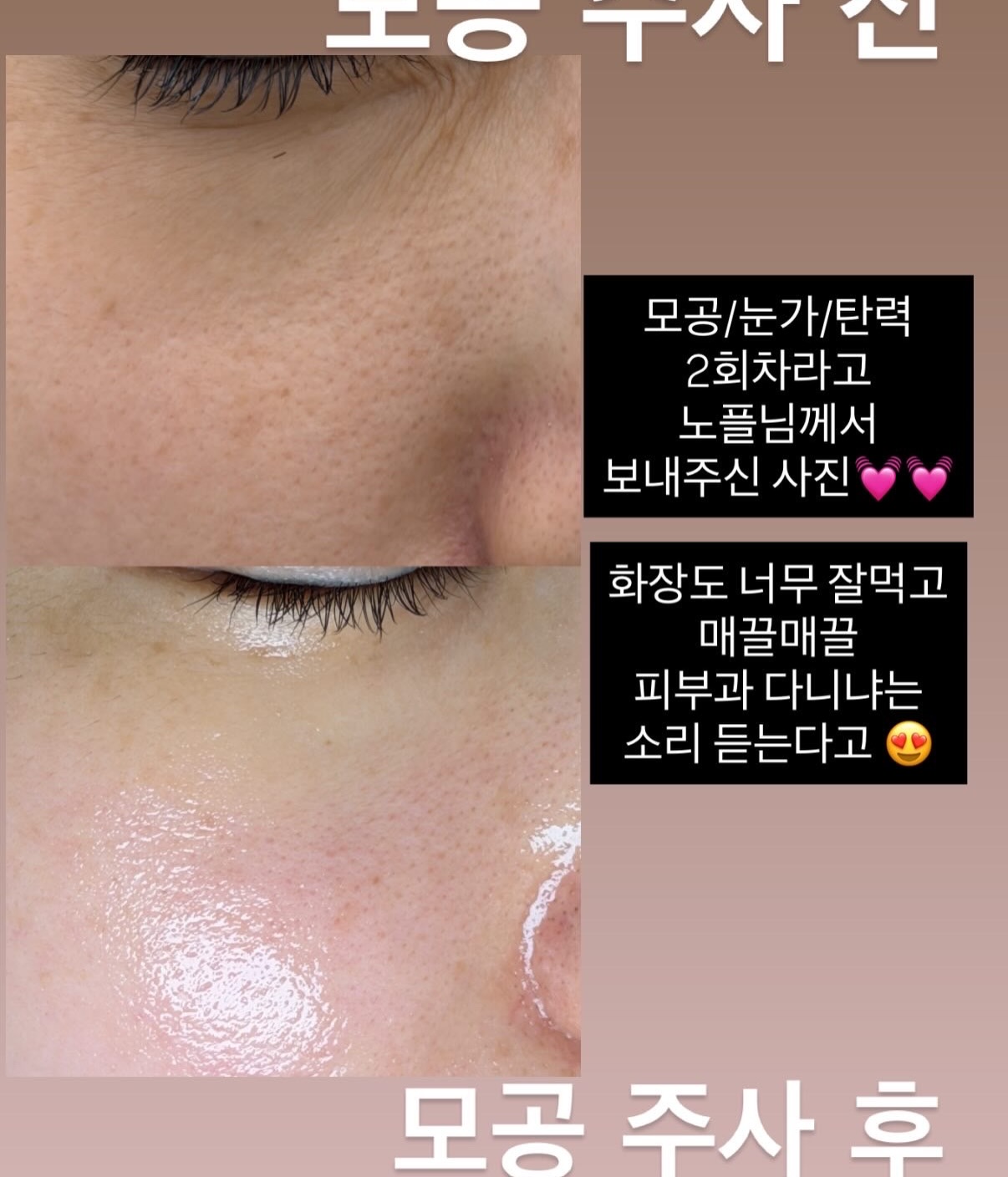 바이오워싱 면 티셔츠 8