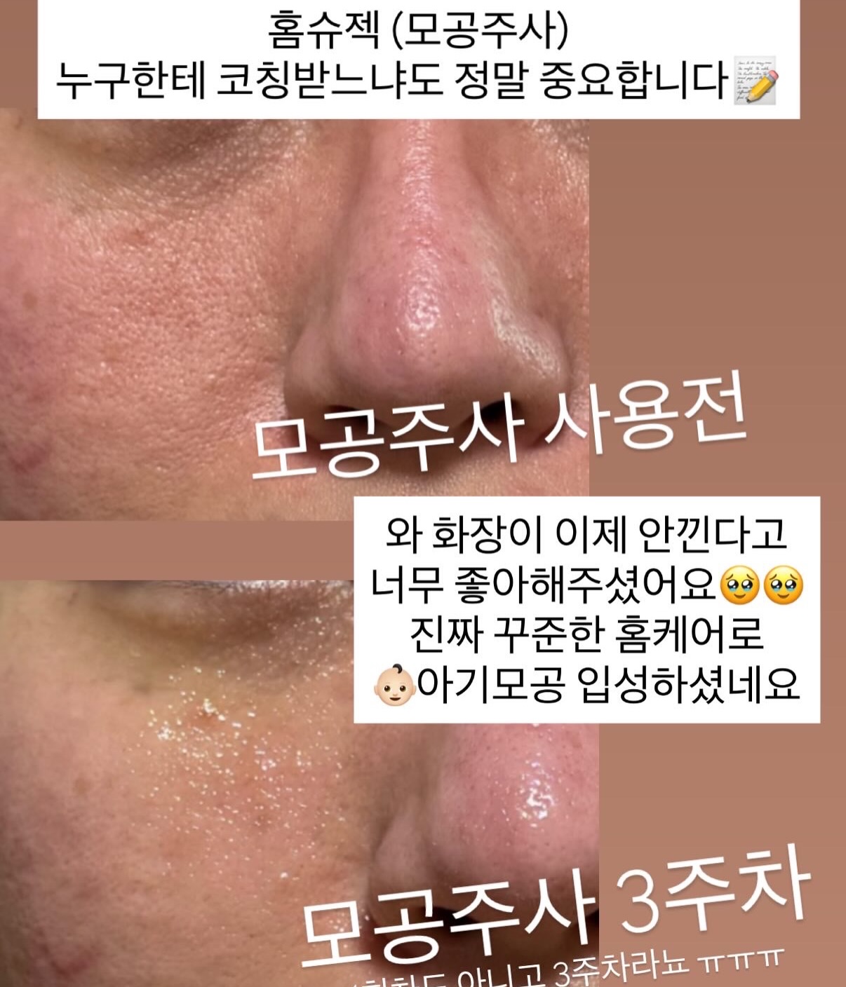 바이오워싱 면 티셔츠 9