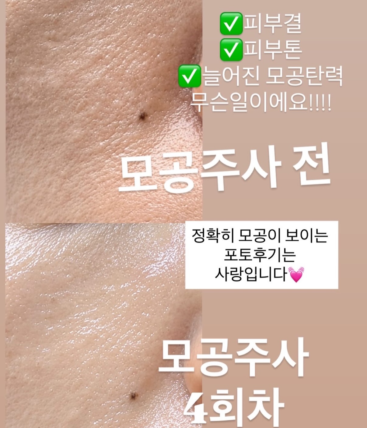 바이오워싱 면 티셔츠 10