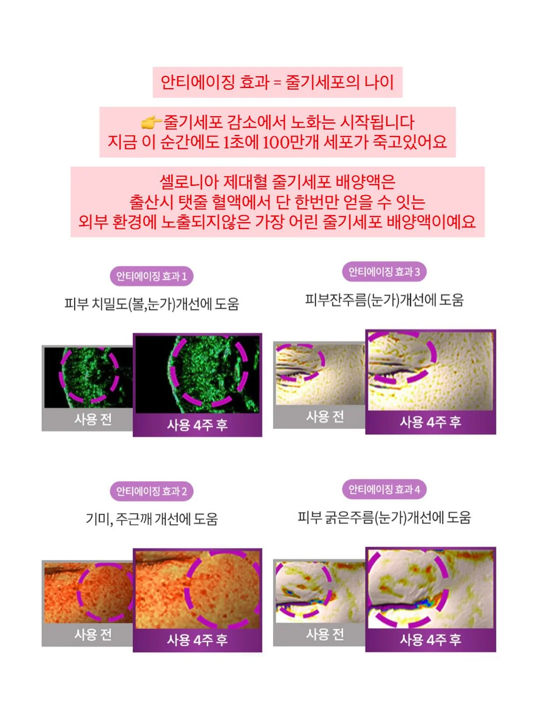 스톤 페인트 7
