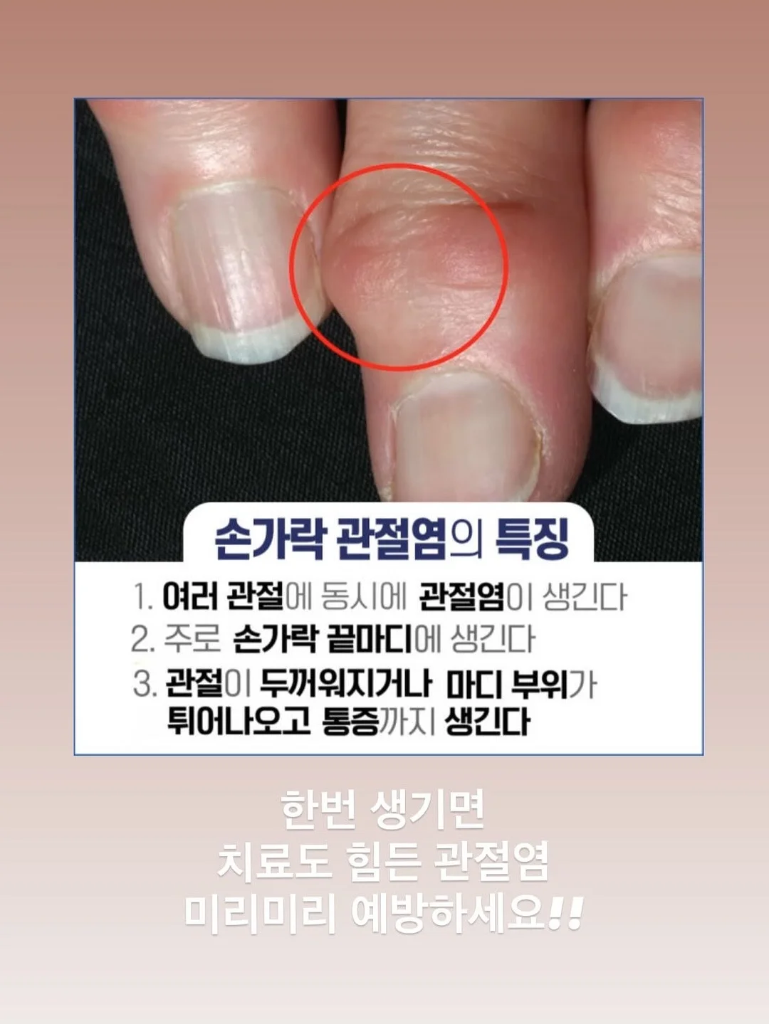 꽃 모양 물 분사 장치 3