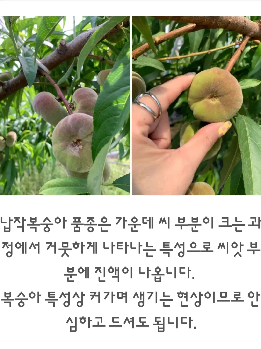 플랫 시스루 레그 워머 발토시 9