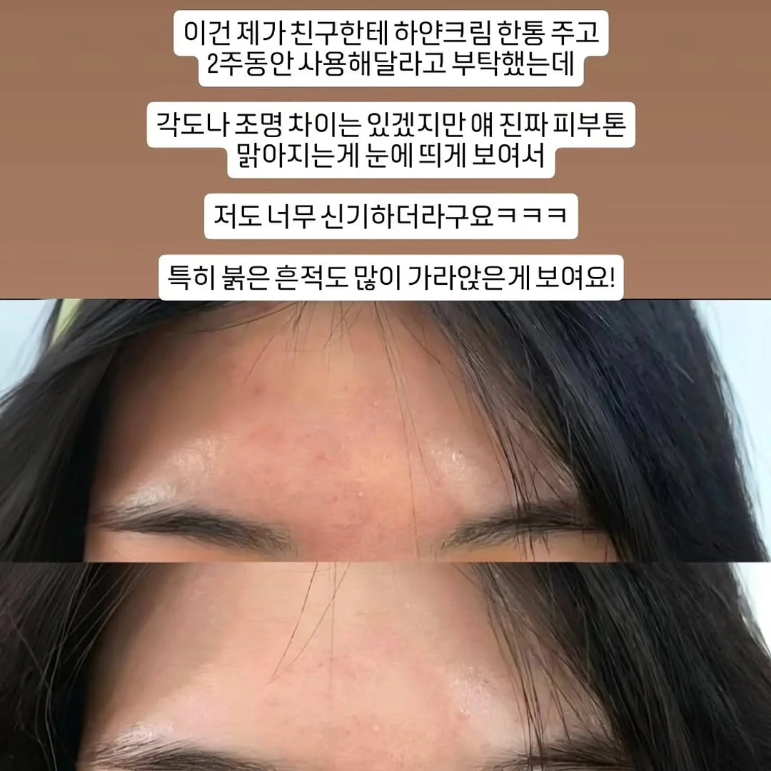올리독 하네스 2