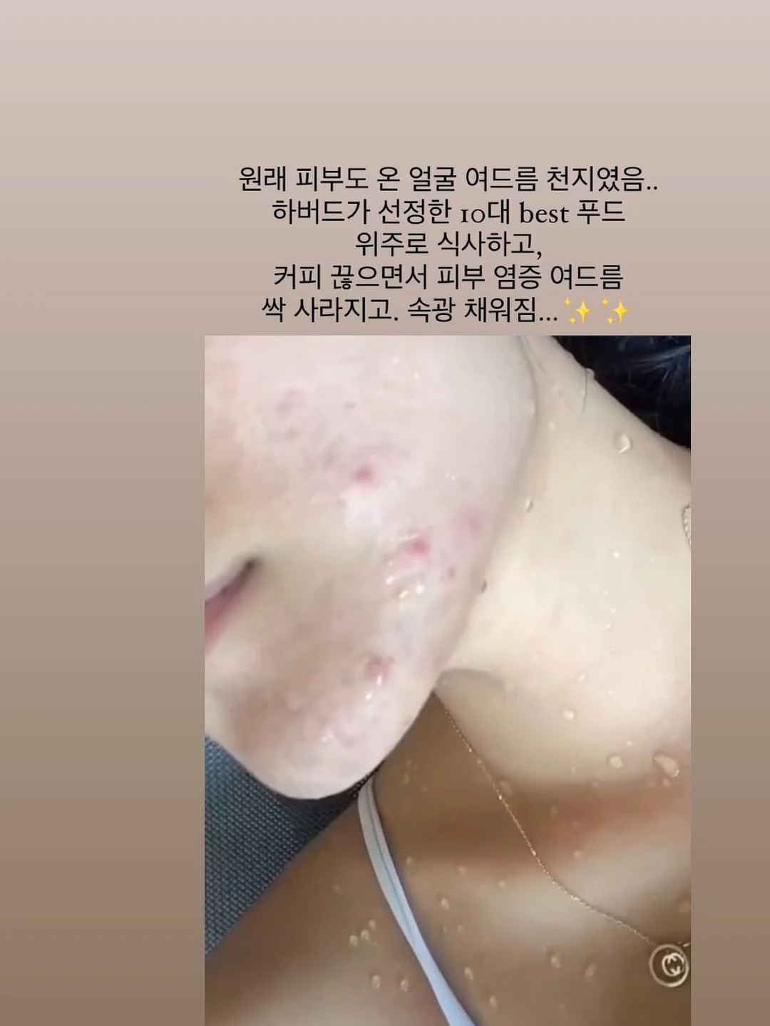아디다스 믹스드 티셔츠 11
