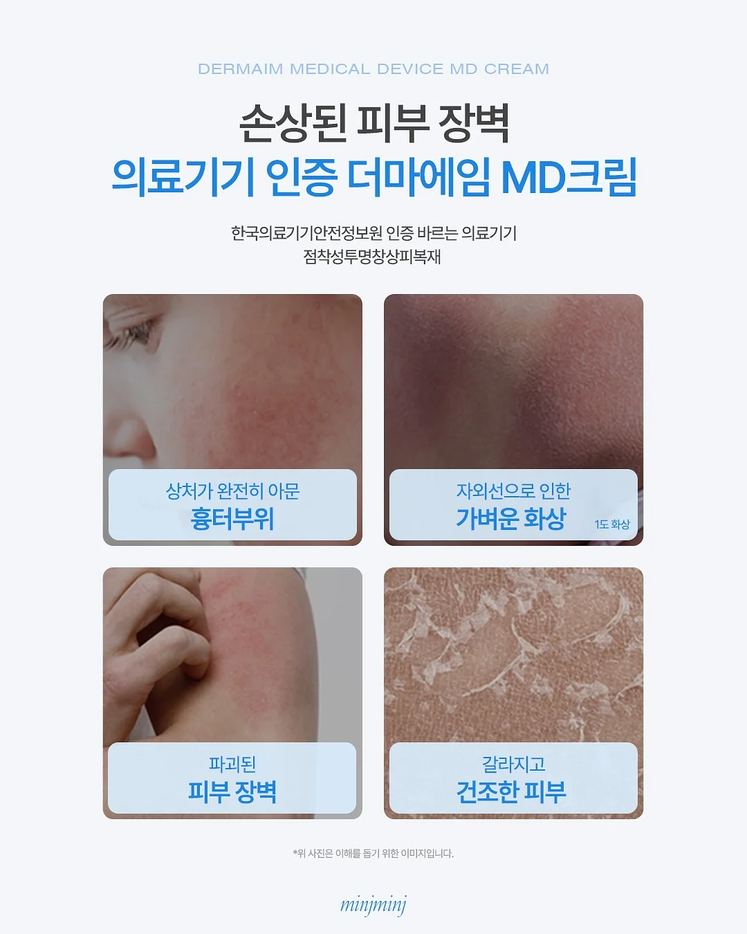 퍼피레드 모바일 5