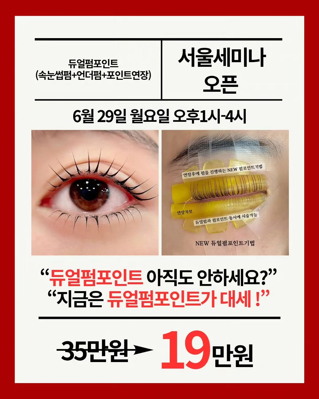 카네이션 과일바구니 1