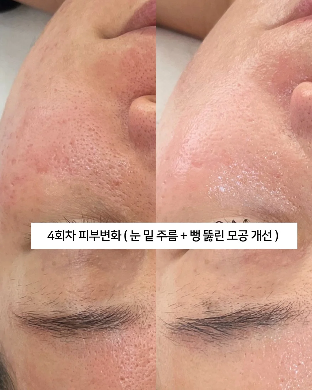 NICE체크아웃 8