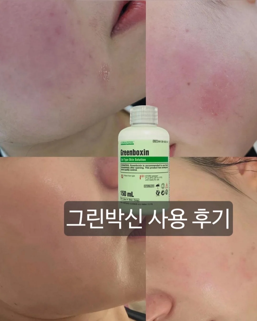 네일 펜 14